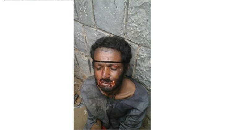 القبض على "مصاص دماء" في اليمن