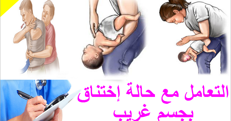 الظاهرة: حلقة عمل تدريبية في مجال إسعاف الحياة الرئيسي للقلب والرئتين