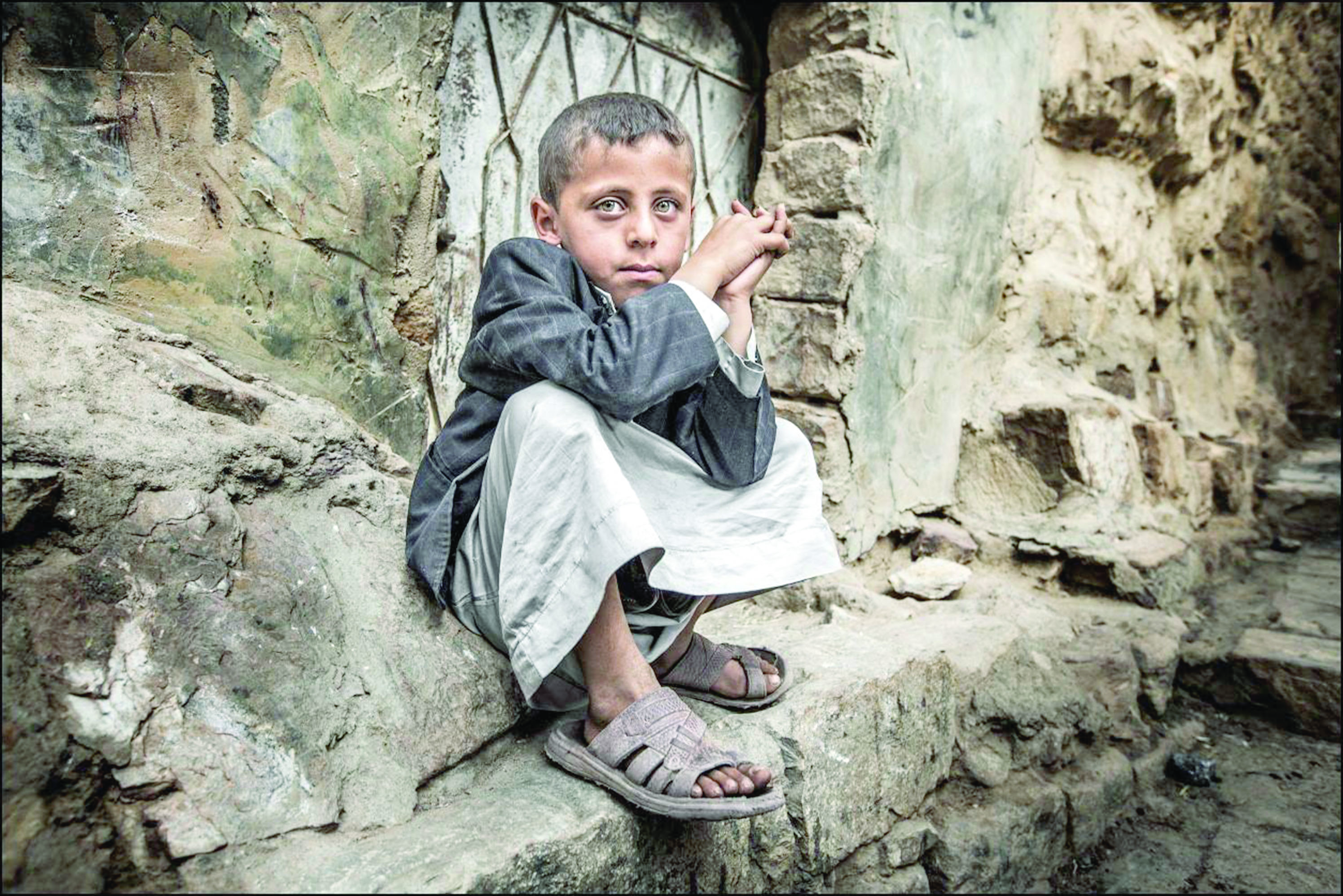 يونيسف: أكثر من مليون ونصف طفل يمني يعانون من سوء التغذية