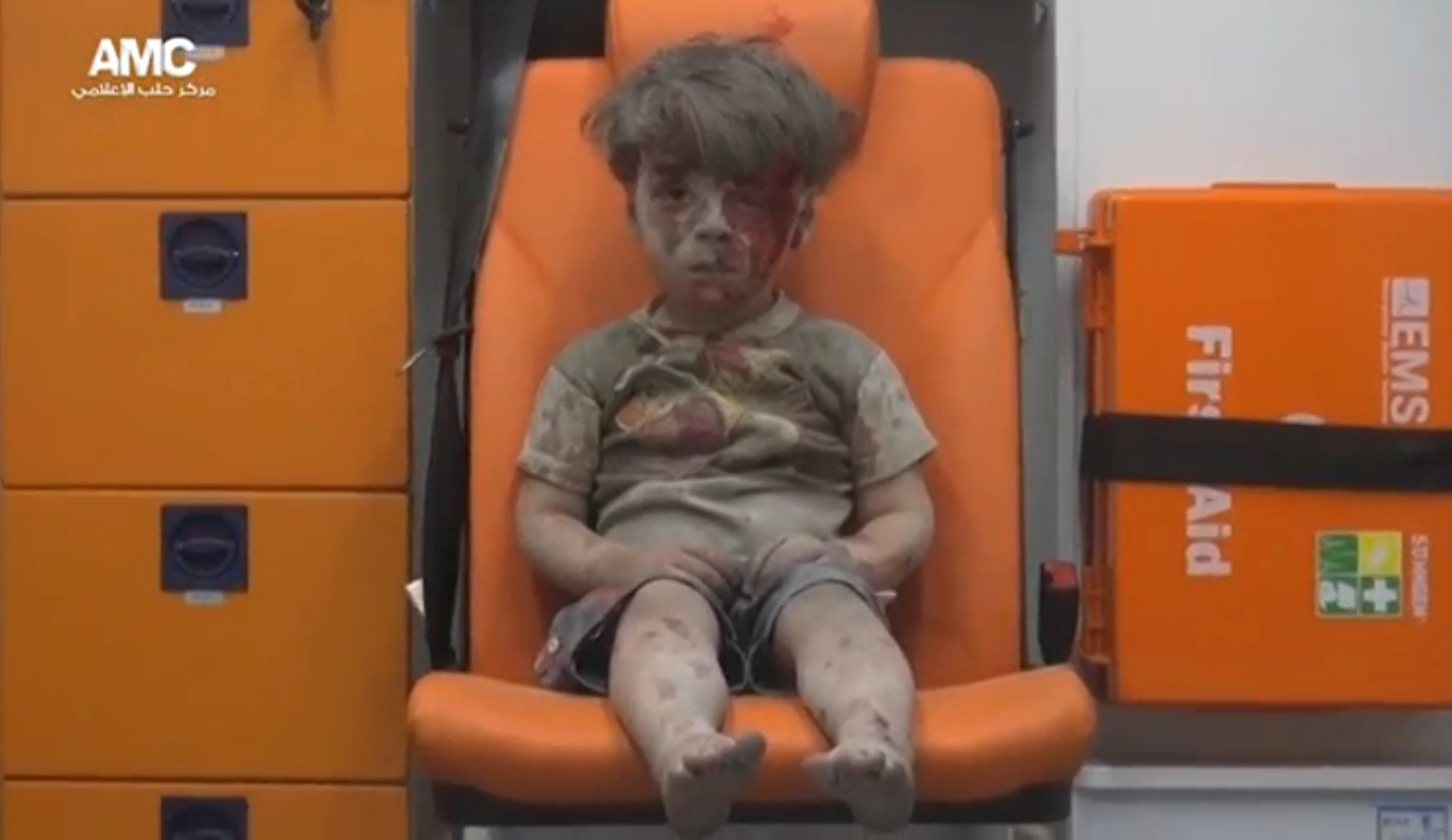Heartbreaking photo of injured Syrian child shows human cost of war