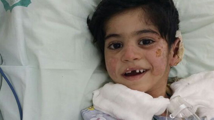 A smile at last on the face of Jordanian boy injured in Oman car fire