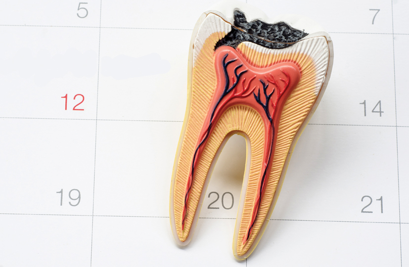 Oman health: Significance of re-root canal treatment