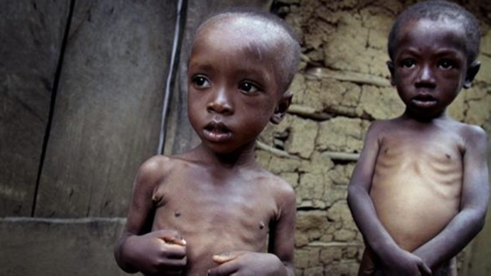 تراجع معدلات سوء التغذية في افريقيا الى 16,3% خلال 12 عاما