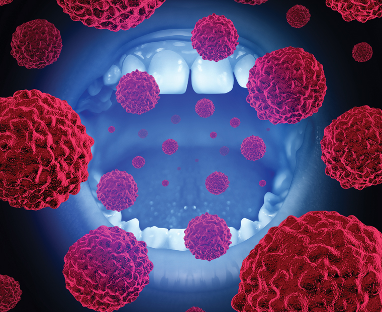 Oman wellnes: Detecting oral cancer early