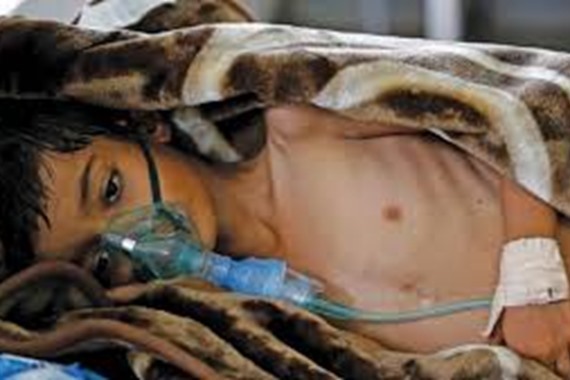 52 ألف شخص مشتبه بإصابتهم بالكوليرا في اليمن