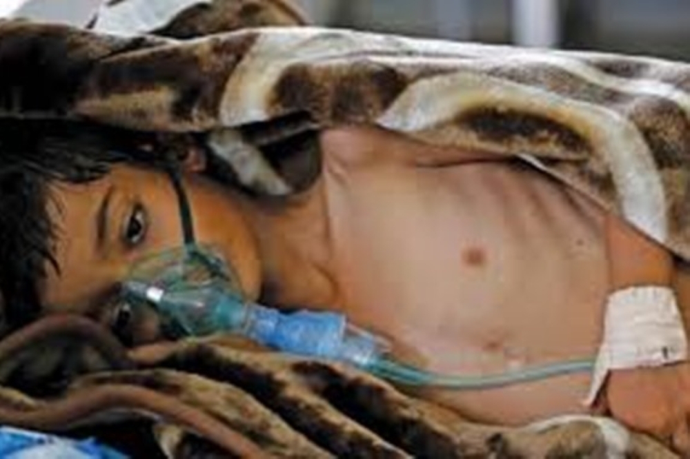 ارتفاع حالات الوفاة بسبب الكوليرا في اليمن إلى 676 حالة