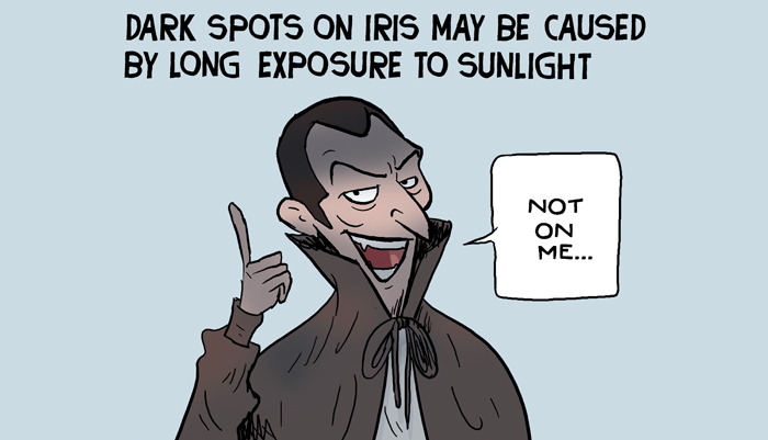 Dark spots on iris