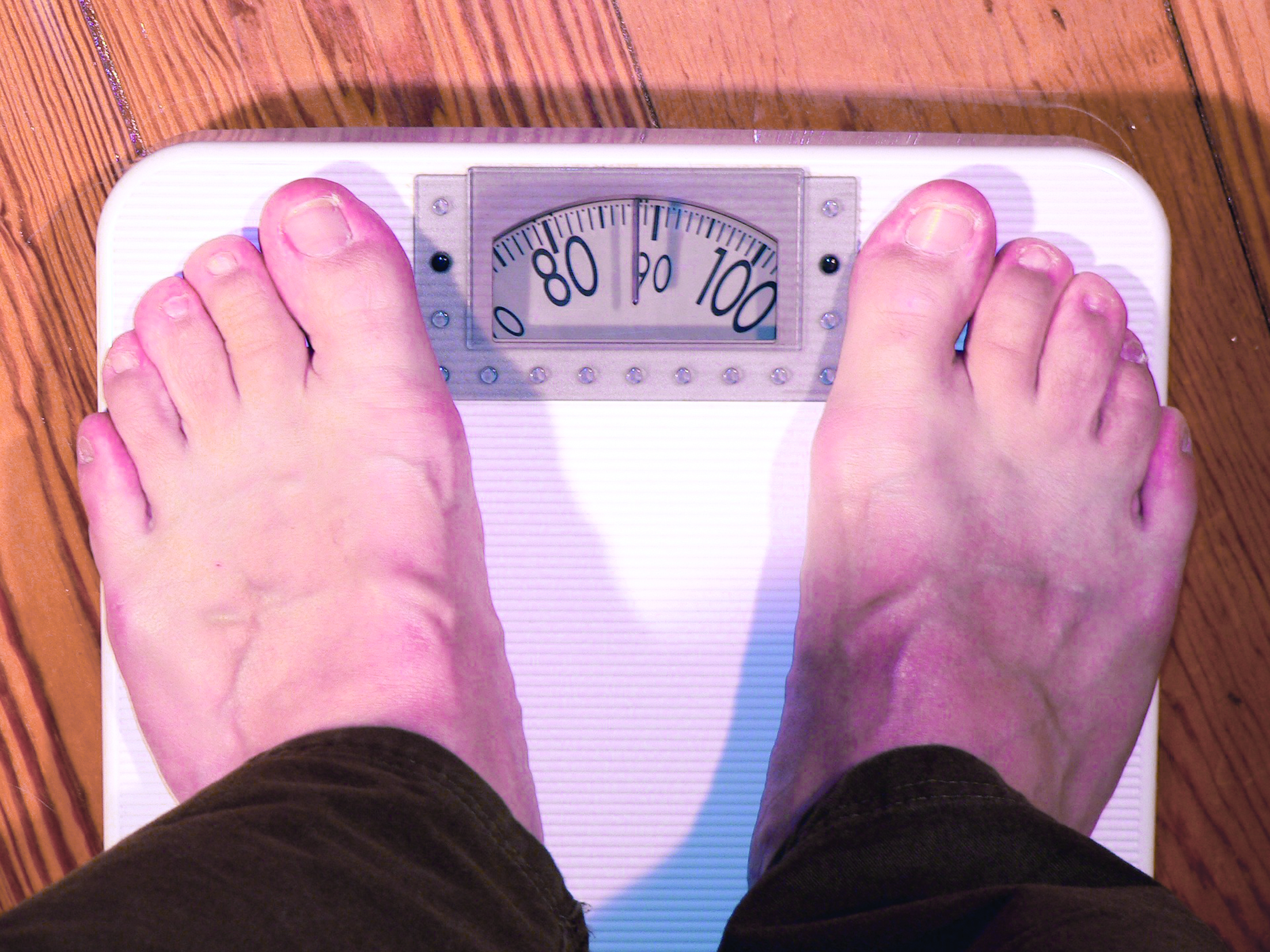 باحثون يتوصلون إلى طريقة جديدة لعلاج مرض السمنة