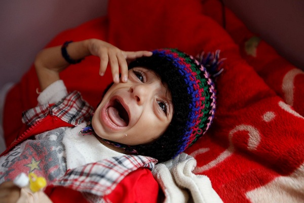 10 ملايين طفل يمني بحاجة لمساعدات عاجلة