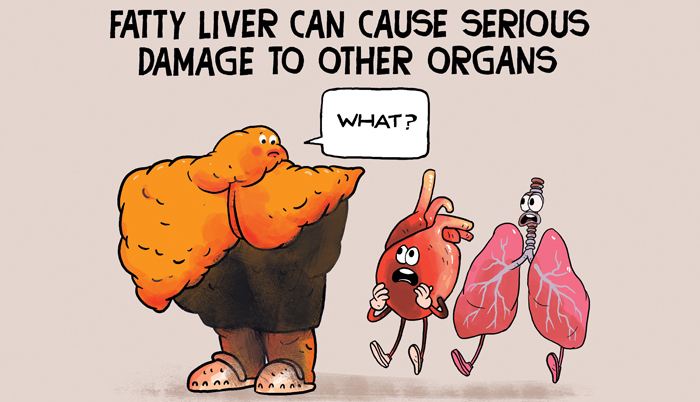 Fatty liver can cause serious damage to other organs