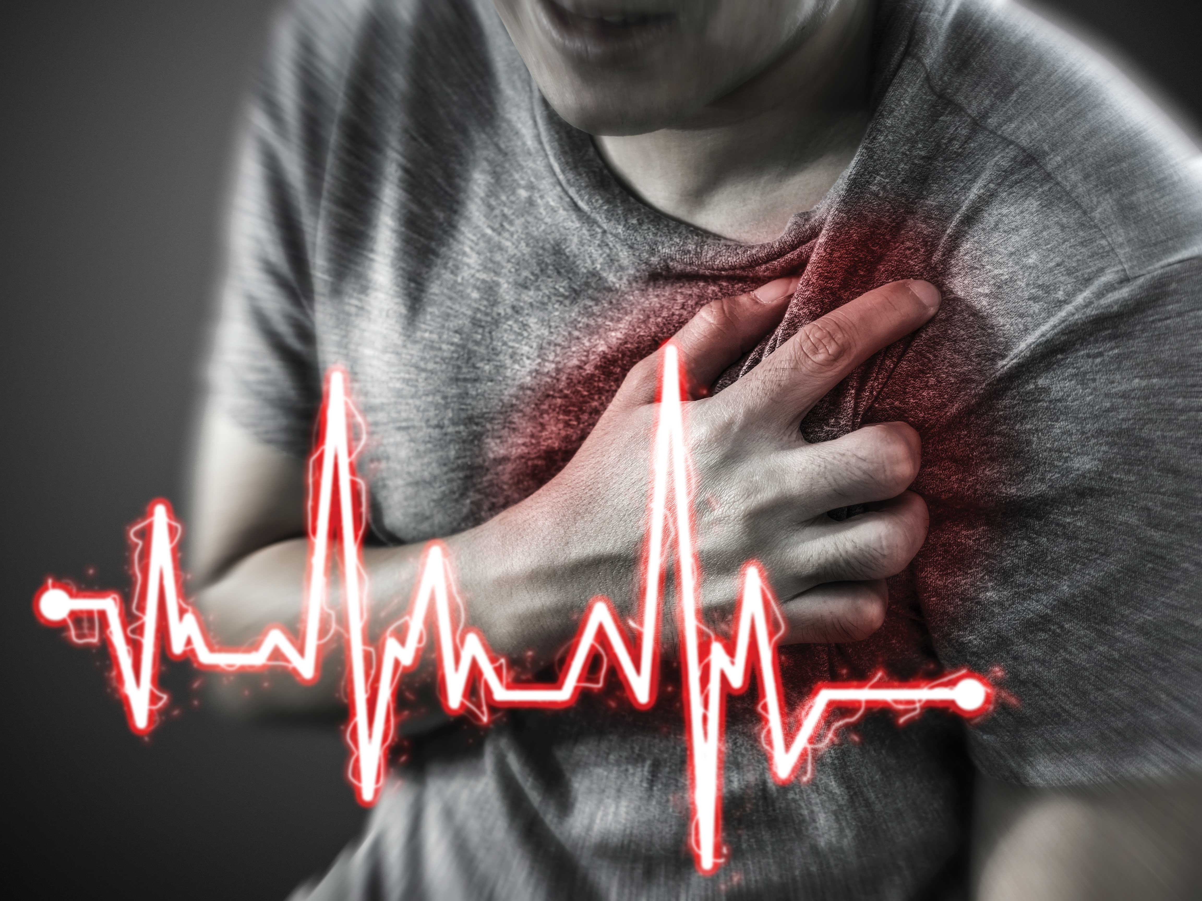 Cardiac rehabilitation programme reduces risk of repeat heart attacks