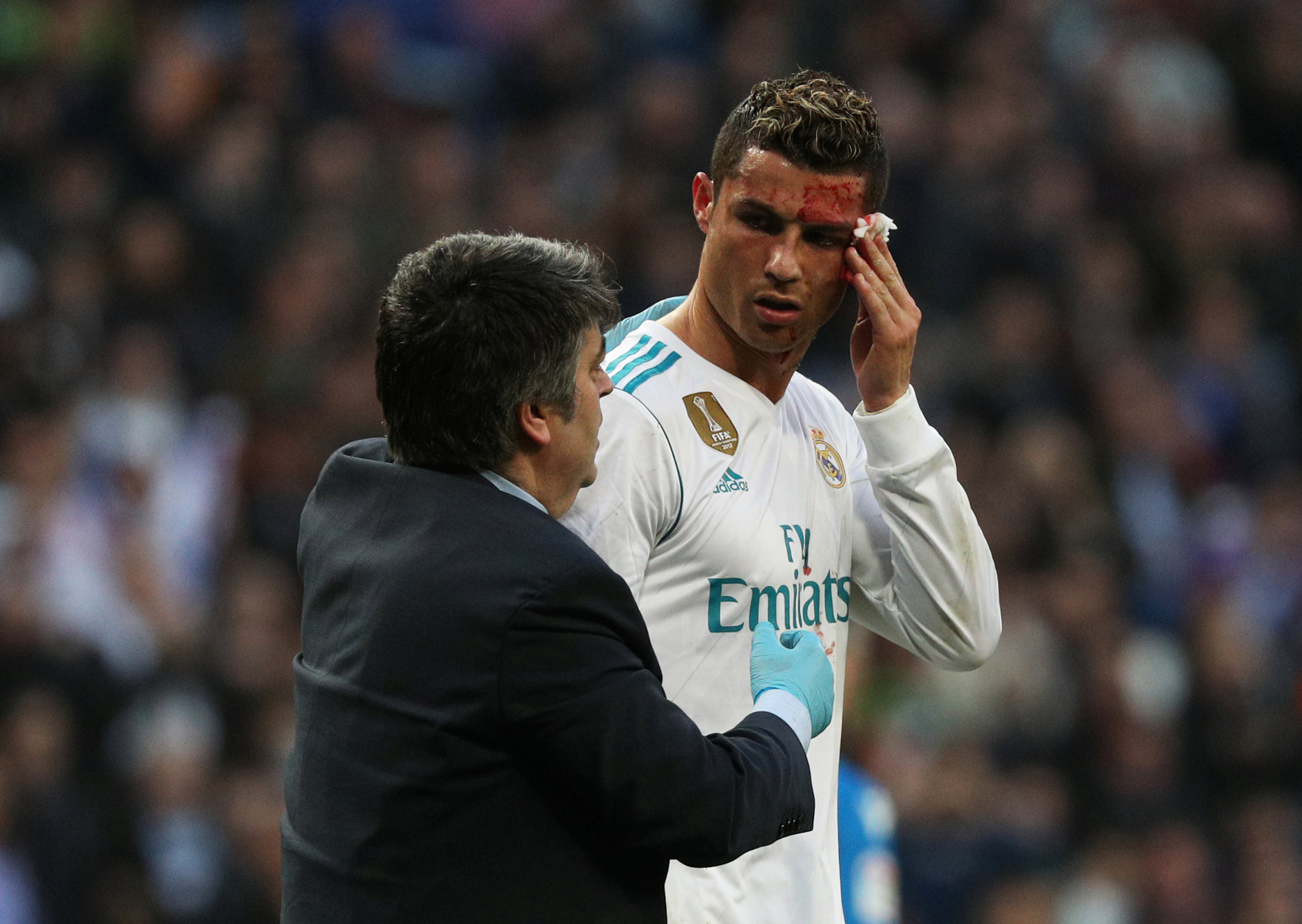 Football: Ronaldo 'still handsome' after face injury