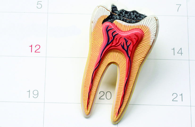 A new technology in root canal treatment