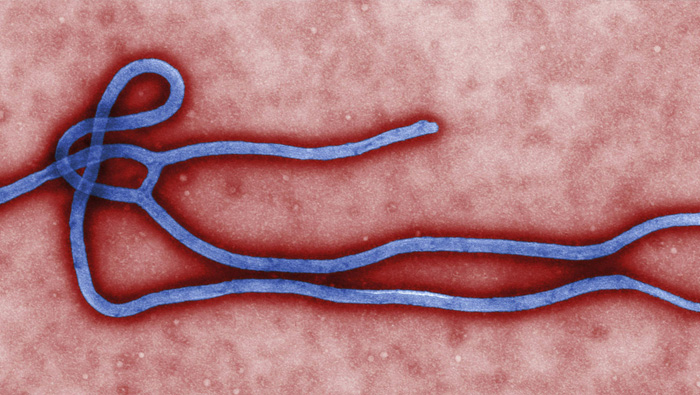 17 deaths reported in Congo as Ebola outbreak confirmed