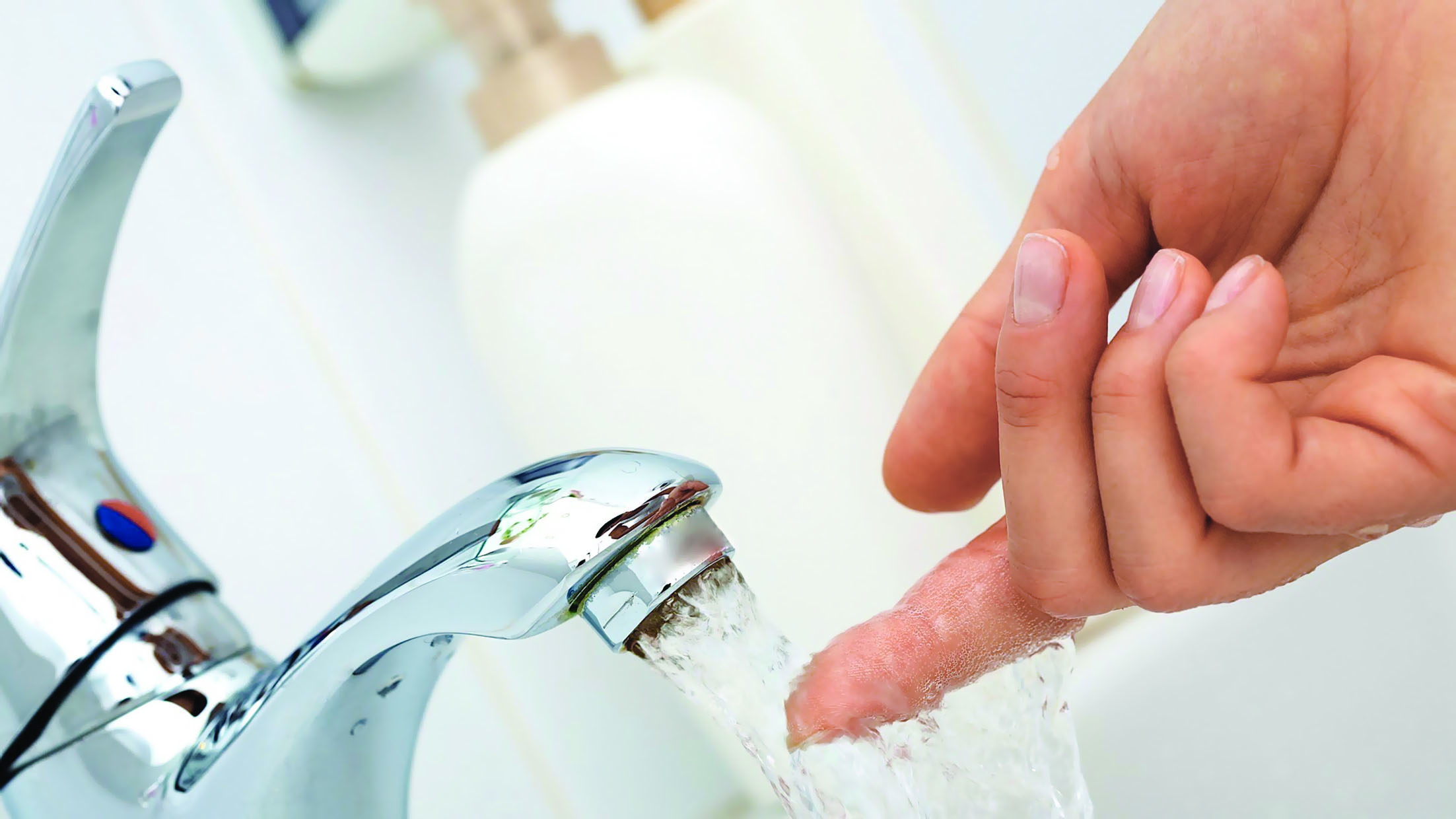 5 علاجات للحروق الناجمة عن الماء الساخن