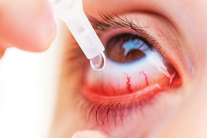5 common behaviours that could be hurting your eyes