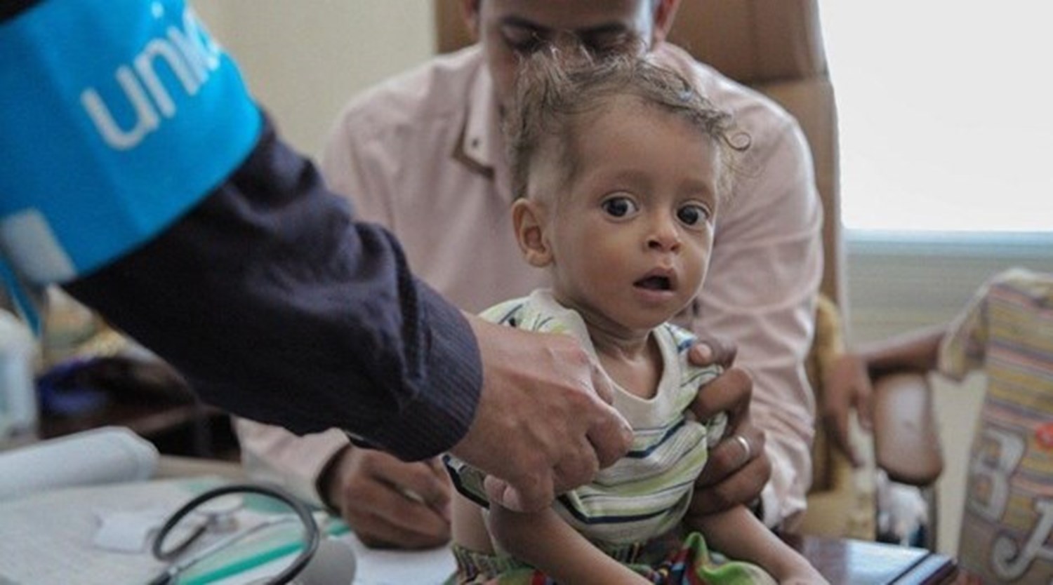 اليمن يمر بأسوأ أزمة جوع في العالم.. والأمم المتحدة تسعى لمنع المجاعة