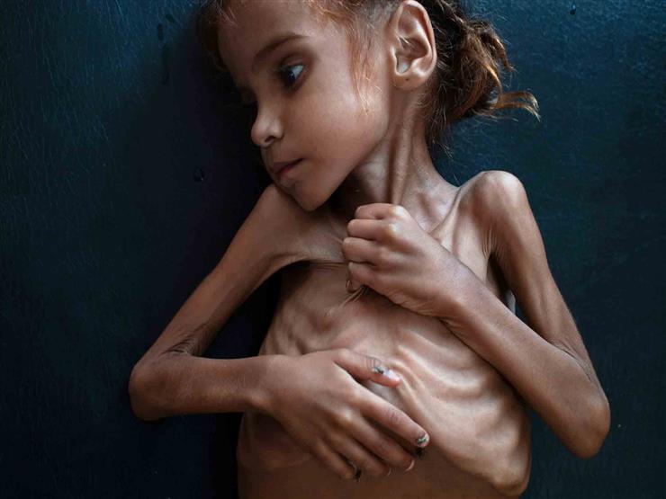 شاهد: صورة طفلة تختصر مأساة اليمن.. ومجلة أمريكية تكرمها بهذه الطريقة