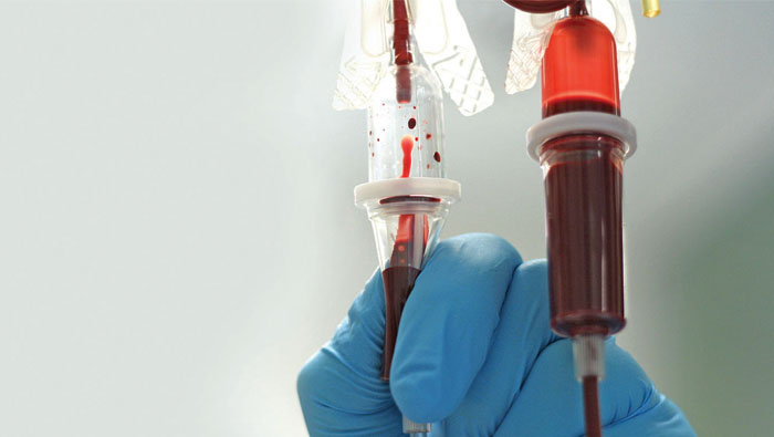 Oman blood bank issues urgent call for A- group donors