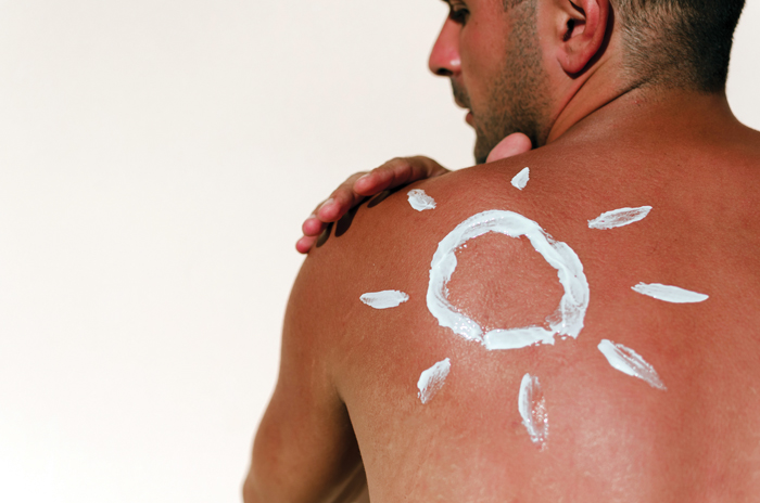 Things you can do to tackle sunburn