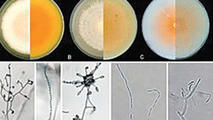 Omani discovers new type of fungus strain inside human body