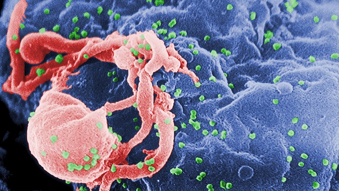 U.S. scientists identify new HIV strain, first in nearly 20 years