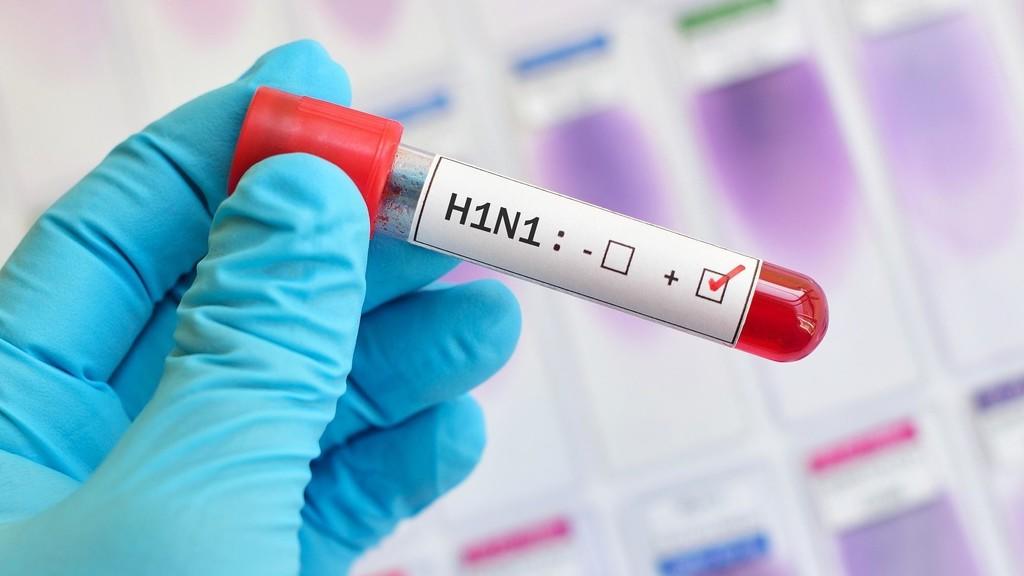 الأردن : ارتفاع حالات الإصابة بانفلونزا الخنازير إلى 102 حالة