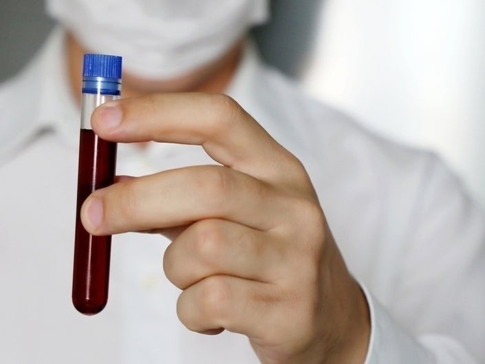 No cases of coronavirus in Oman: Minister of Health