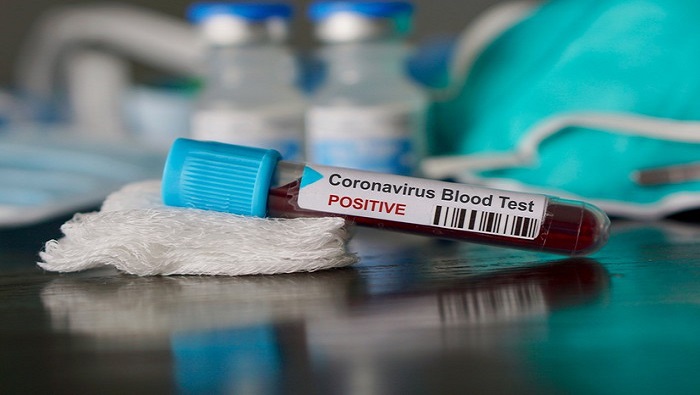 Second Coronavirus patient in Oman recovers