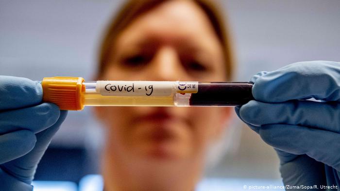 US approves 45-minute coronavirus test