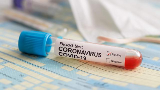 Oman registers 74 new coronavirus cases