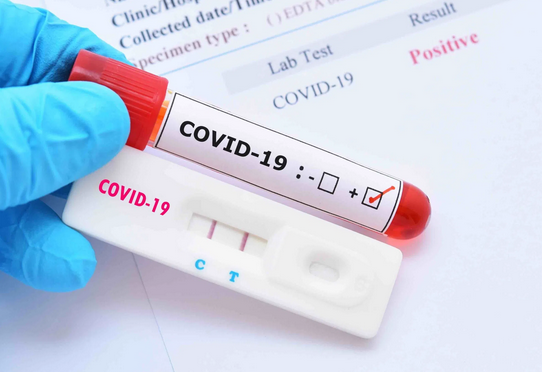 327 new coronavirus cases reported in Oman
