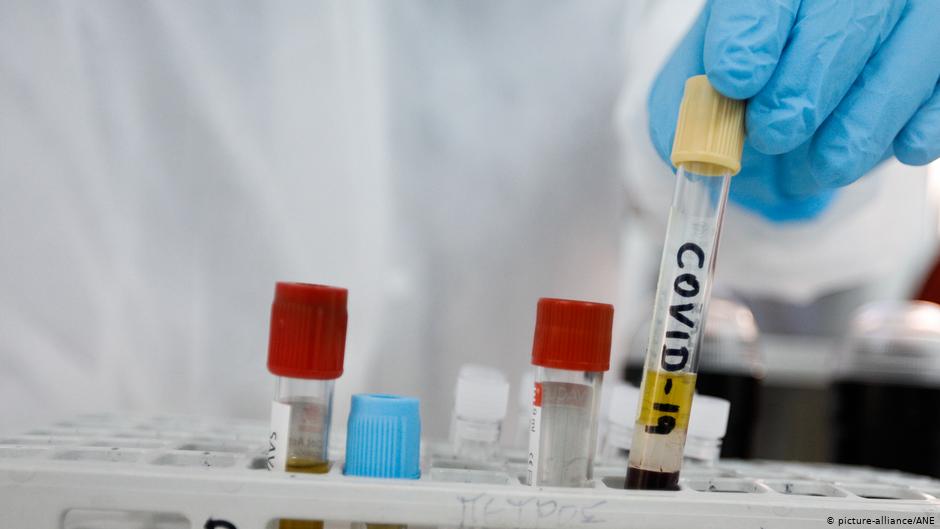 Coronavirus vaccine human tests show initial promise