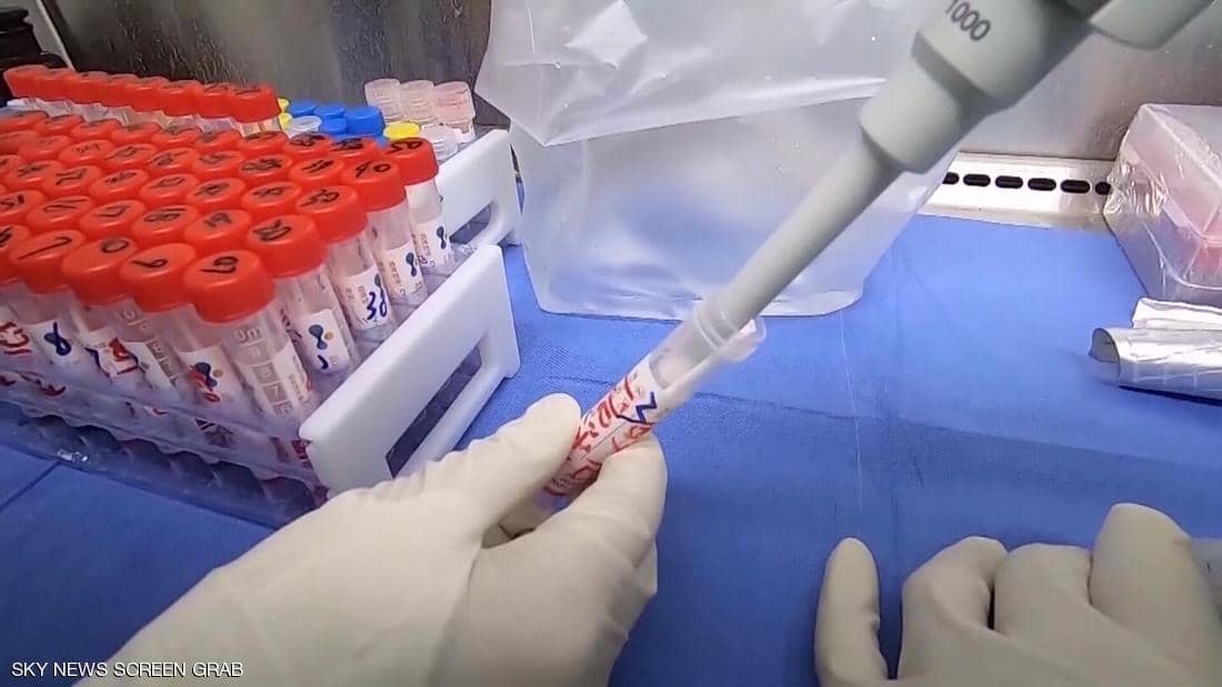 طفرة جديدة تطرأ على كورونا.. وآمال بتحوله إلى "فيروس وديع"