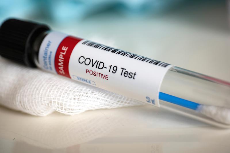 1067 new coronavirus cases reported in Oman