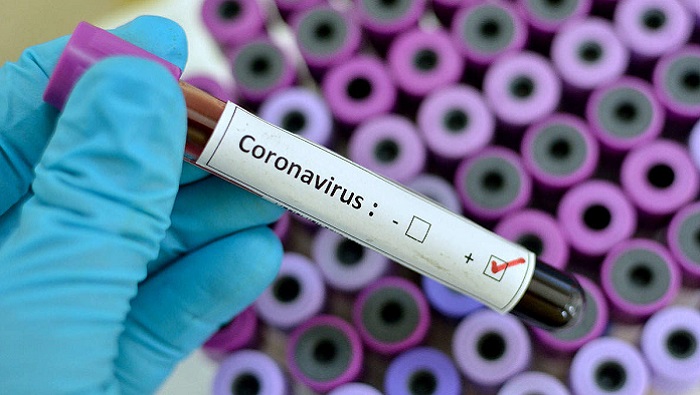 Coronavirus death toll rises to 67 in Oman