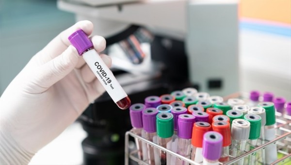 Oman confirms 778 new coronavirus cases