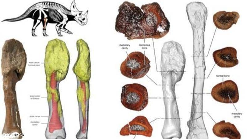 بعد 76 مليون سنة.. علماء يشخصون إصابة ديناصور بالسرطان