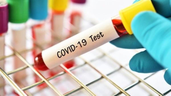 Social media users question accuracy of COVID tests