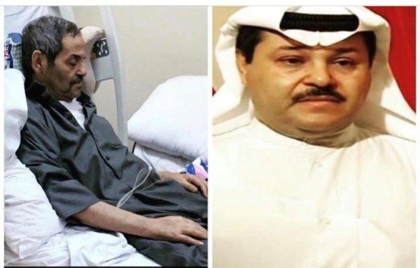 وفاة الفنان الكويتي صادق الدبيس