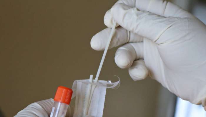 Anal swabs being used to test Chinese for COVID