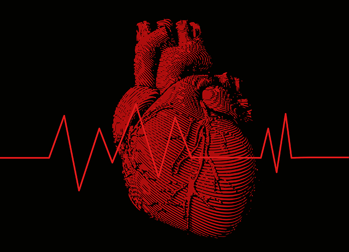 Don't ignore irregular heartbeat