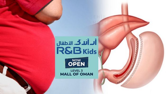 دراسة جديدة تتحدث عن إيجابيات جراحات المعدة لإنقاص الوزن