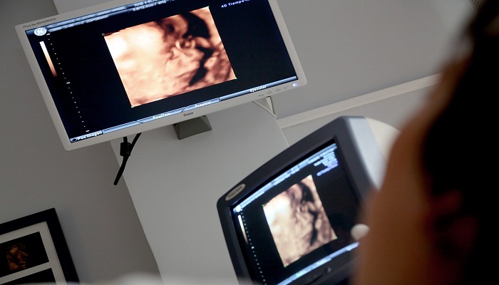 Royal Hospital issues clarification about ultrasound scans