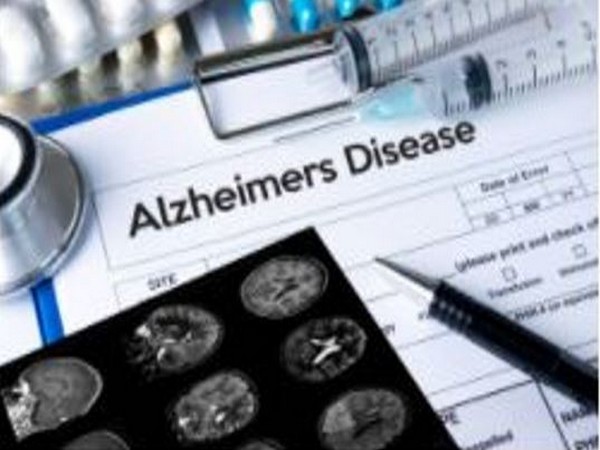 Loss of neurons makes Alzheimer's patients drowsy: Study