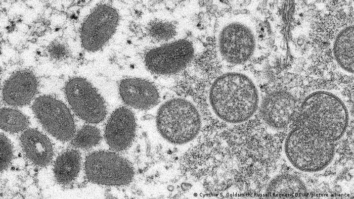 Monkeypox: Portugal reports cases as outbreak spreads