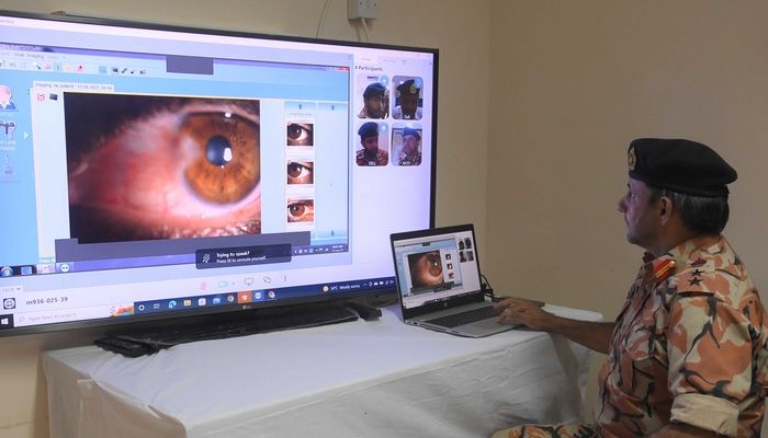 تدشين تقنية التطبيب عن بُعد لعلاج العيون بالمركز الطبي بمدرعات سلطان عُمان