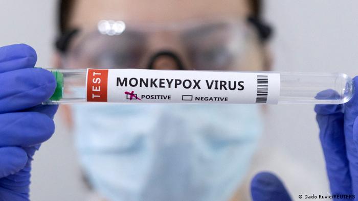 US declares Monkeypox outbreak a Public Health Emergency