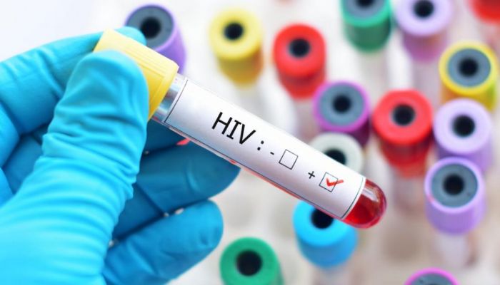 رصد 160 حالة جديدة مصابة بالإيدز في سلطنة عمان سنويًا