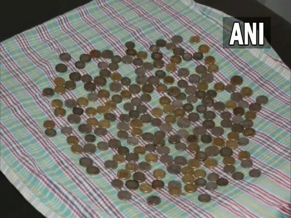 Doctors remove 187 coins from man's stomach in Karnataka's Bagalkot